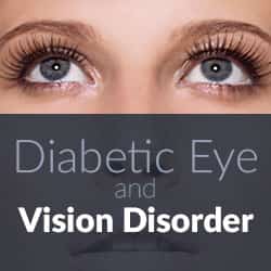 How to Prevent Diabetic Eye Disease